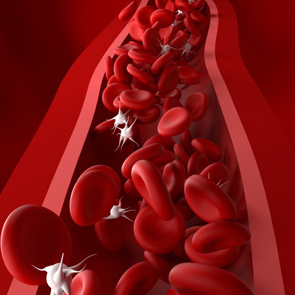 ITP (Immunthrombozytopenie)
